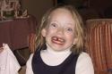 050125_b.tooth_125.jpg